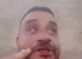 الاستغلال و التهميش والاعتداء يكشف الوجه القمعي الحقيقي لعصابة الرابوني